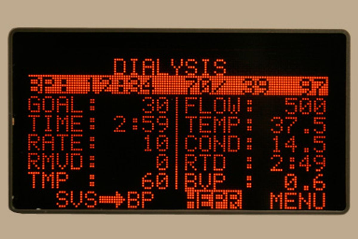 A digital readout is displayed as a patient undergoes dialysis 