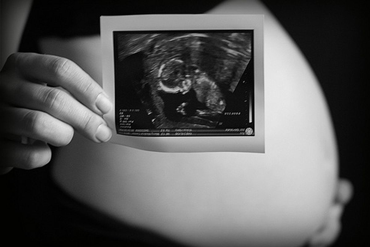 Беременность узи недели беременности видео