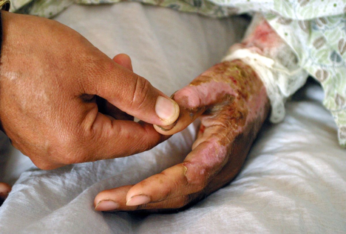 The mother of nineteen-year-old Zahara holds her hand while she lies in her hospital bed in Herat, Afghanistan April 7, 2004. Zahara, trapped in an unhappy marriage, attempted to commit suicide by burning herself with petrol. The Afghan Independent Human Rights Commission has recorded at least 110 cases of self-immolation by women in five parts of the country in the past year. Photo taken April 7. TO ACCOMPANY FEATURE AFGHAN-WOMEN-SUICIDE REUTERS/Farzana Wahidy  AL/FA  (Â© Reuters Photographer / Reuters)
