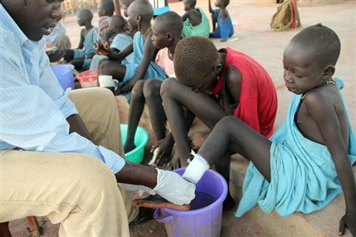 In this Nov.  4, 2010 photo, Ajak Kuol Nyamchiek, 7, watches while John Lotiki, a nurse with the Carter Center, bandages the blister on her leg from where a guinea worm is slowly emerging in Abuyong, Sudan. Nyamchiek is a patient at Centers guinea worm case containment center. Nurses at this center in Abuyong, a village in Awerial County in Southern Sudans Lakes state, bandage the worms twice daily, after gently pulling the worms out several inches each time. If they break while they are being pulled out of the swollen blisters, the wounds become infected and the worms withdraw back into the body, prolonging the pain for the victims. (AP Photo/Maggie Fick) (AP)