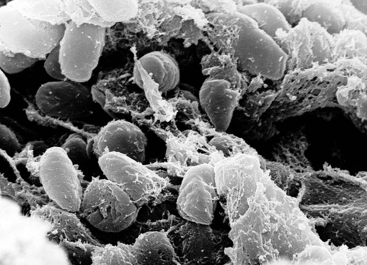 Scanning electron micrograph depicting a mass of Yersinia pestis bacteria (the cause of bubonic plague) in the foregut of the flea vector    (NIH/Wikimedia Commons)