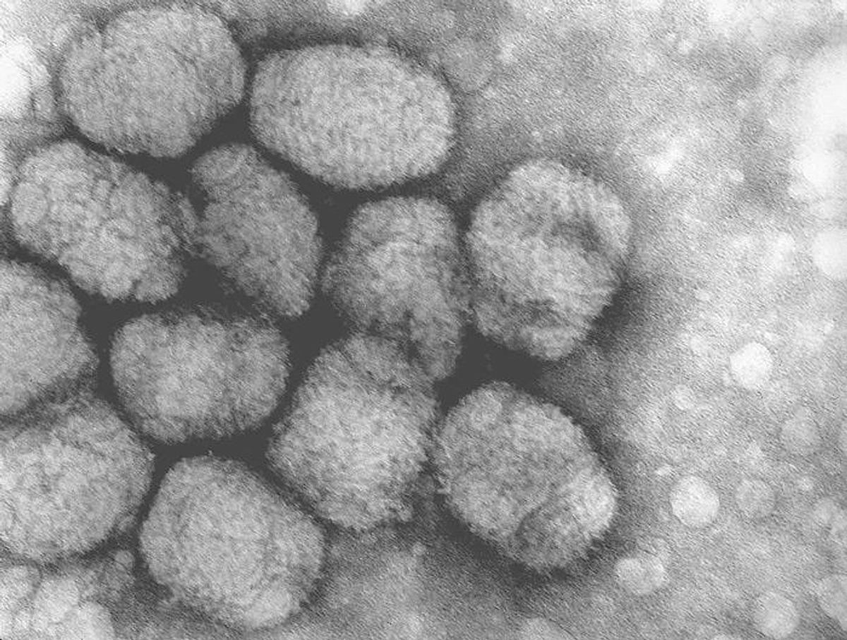 Smallpox virus  (CDC)