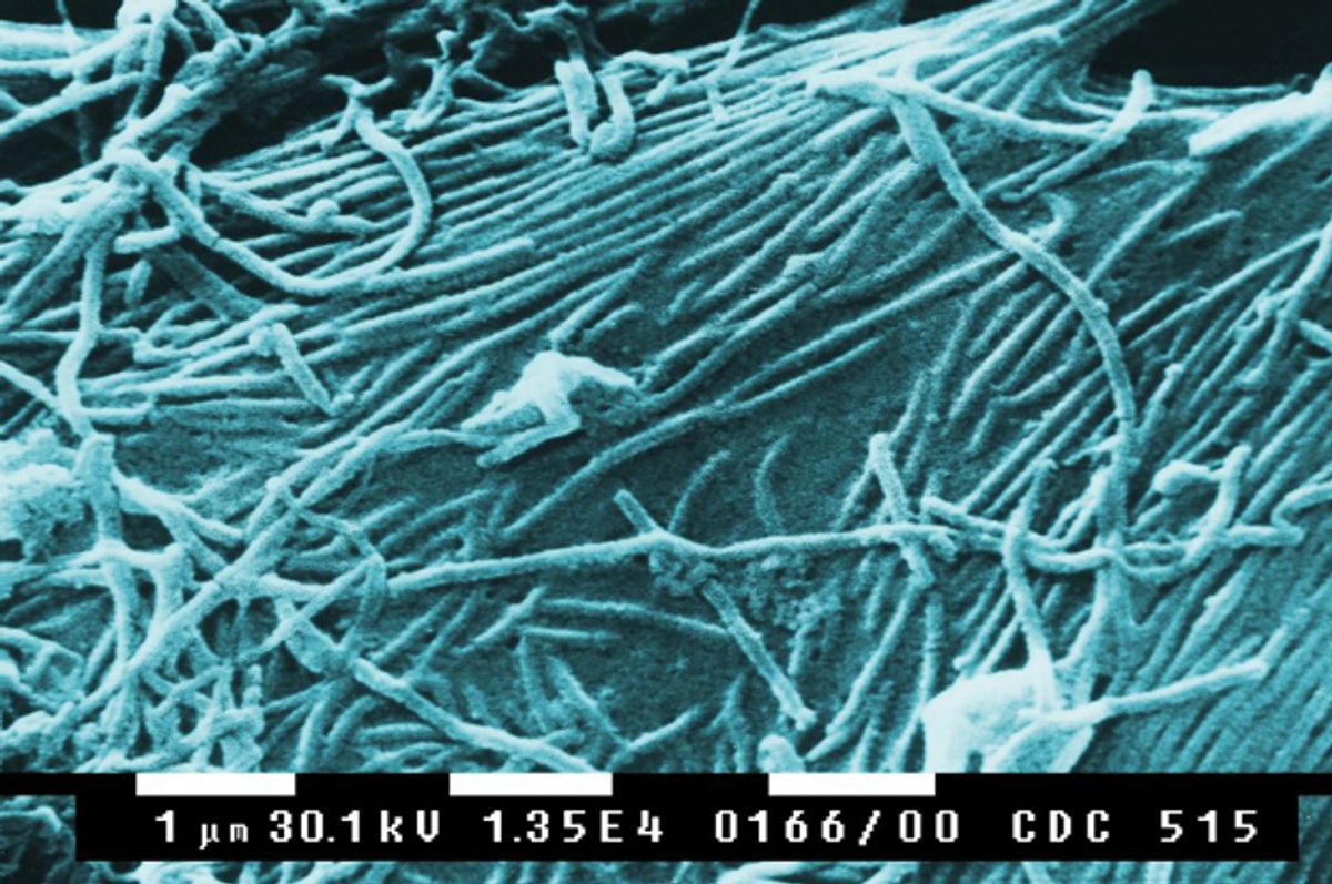 Scanning electron microscopic image of Ebola virions                                                         (Public Library of Science)