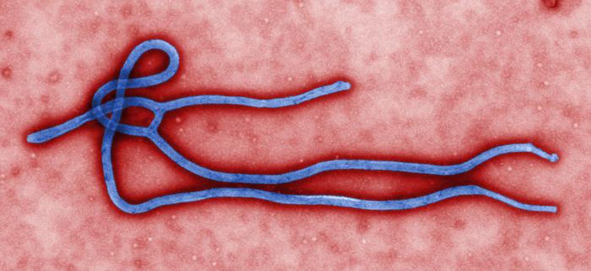 FILE - In this undated file image by the CDC shows an ebola Virus. U.S. health officials on Thursday, July 31, 2014, warned Americans not to travel to the three African countries, hit by an outbreak of Ebola. The travel advisory applies to non-essential travel to Guinea, Liberia and Sierra Leone. (AP Photo/CDC, File)  (AP)