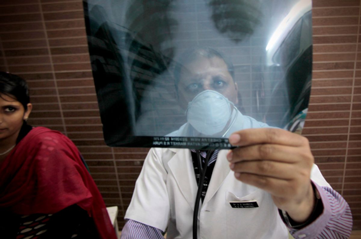 A doctor examines a X-ray of a tuberculosis patient in Jammu, India.          (AP/Channi Anand)