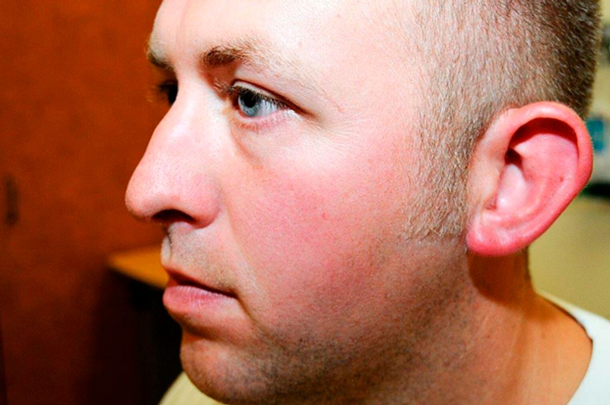 St. Louis County Prosecutor's Office photo shows Darren Wilson photo taken shortly after August 9, 2014 shooting of Michael Brown.      (Reuters)