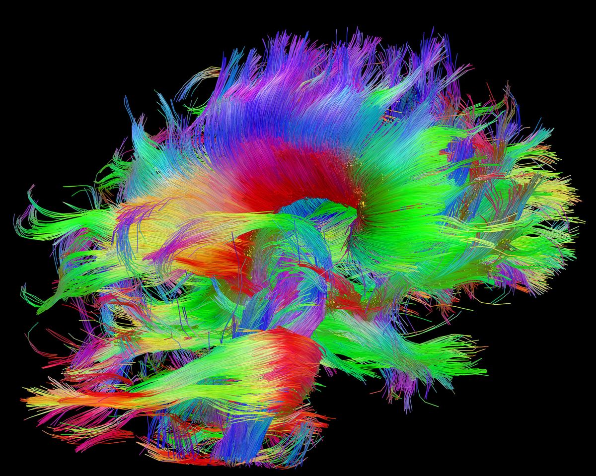  (Courtesy of the Laboratory of Neuro Imaging and Martinos Center for Biomedical Imaging, Consortium of the Human Connectome Project - www.humanconnectomeproject.org, www.loni.usc.edu via AP)