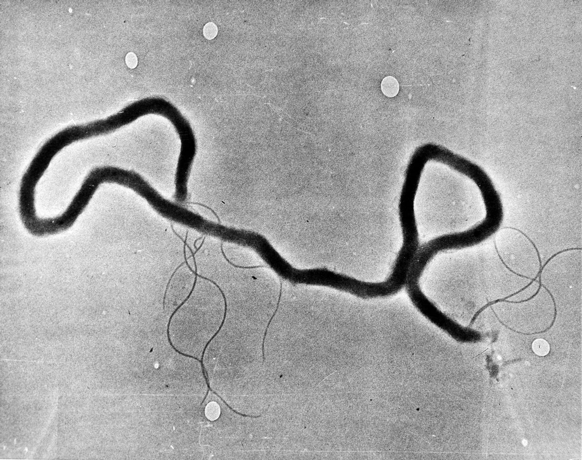 FILE - In this May 23, 1944 file photo, the organism treponema pallidum, which causes syphilis, is seen through an electron microscope. Las Vegas is experiencing a syphilis outbreak, as health officials warn of a national spike in cases that some are tying to increased testing, as well as the prevalence of anonymous sex through social media and a less consistent use of condoms. (AP Photo, File) (AP)