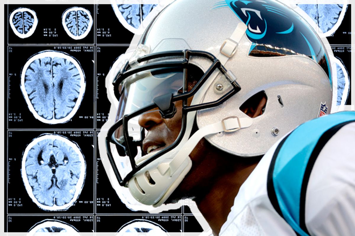 NFL's safest helmet ever may not be enough to stop concussions