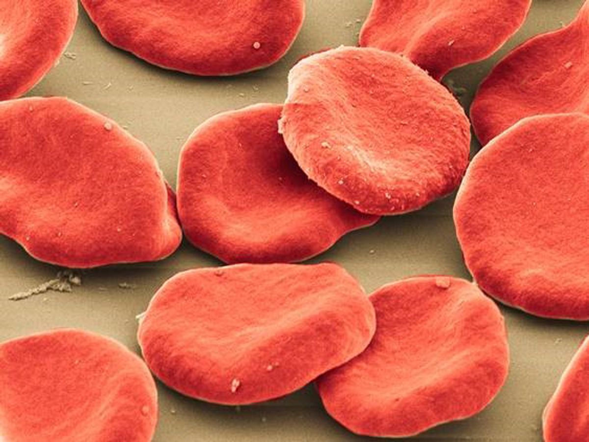 This photo provided by the University of Pittsburgh, Center for Biologic Imaging shows colorized scanning electron micrograph of red blood cells.  (University of Pittsburgh, Center for Biologic Imaging via AP) (AP)