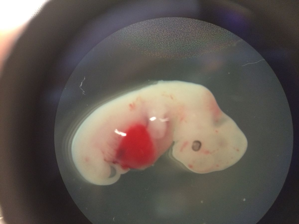 This undated photo provided by the Salk Institute on Jan. 24, 2017 shows a 4-week-old pig embryo which had been injected with human stem cells. The experiment was a very early step toward the possibility of growing human organs inside animals for transplantation. (Salk Institute via AP) (AP)