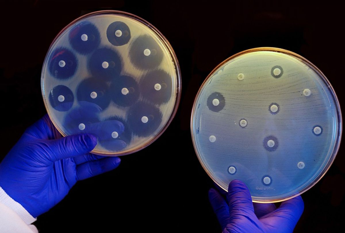 Antibiotics are placed in petri dishes filled with bacteria. In the dish on the left the bacteria will not develop near the antibiotics. In the right petri dish, antibiotic resistant bacteria are growing. (Universal History Archive/Universal Images Group via Getty Images)