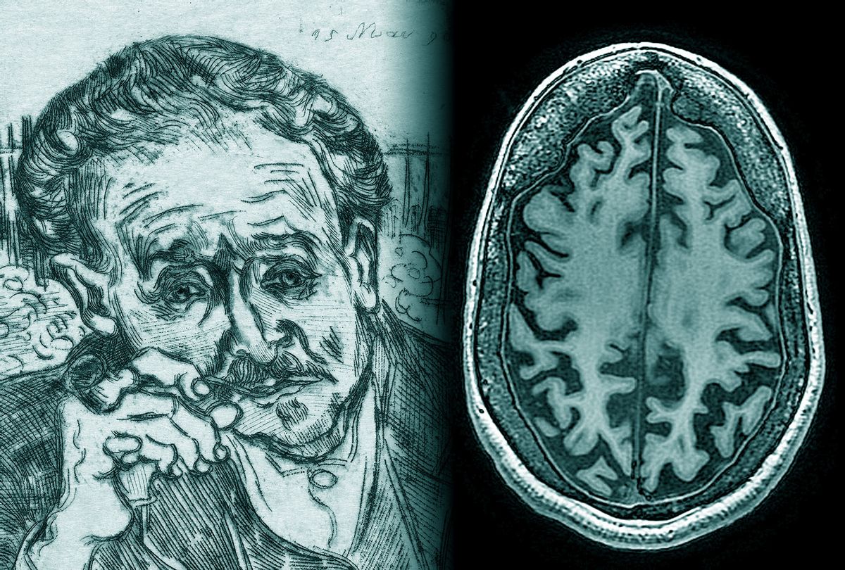 "Portrait Of Dr. Gachet With Pipe" by Vincent van Gogh | Radial cross-section MRI cranial scan (Photo illustration by Salon/Getty Images)