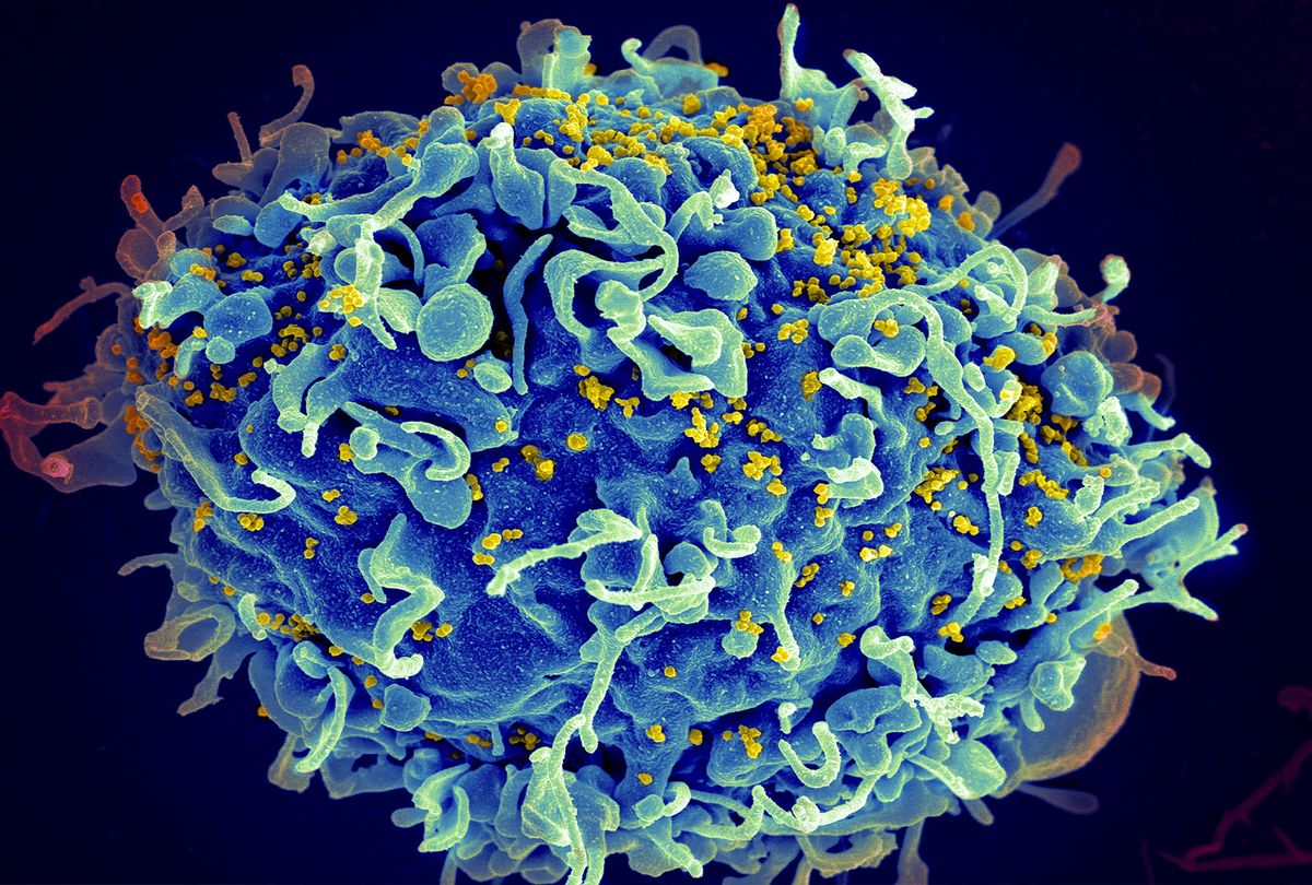 Scanning electron micrograph of HIV particles infecting a human H9 T cell (Getty Images)