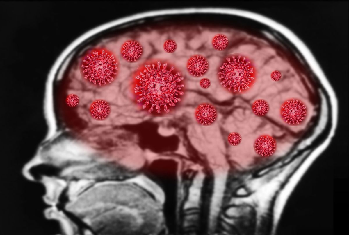Coronavirus and the Brain (Getty Images/Amornrat Phuchom)