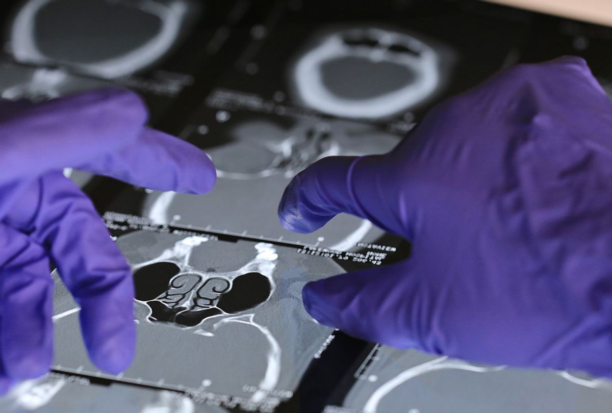 Oncology surgeon examines x-ray images prior to removing the cancerous tumor (Douglas Sacha/Getty Images)