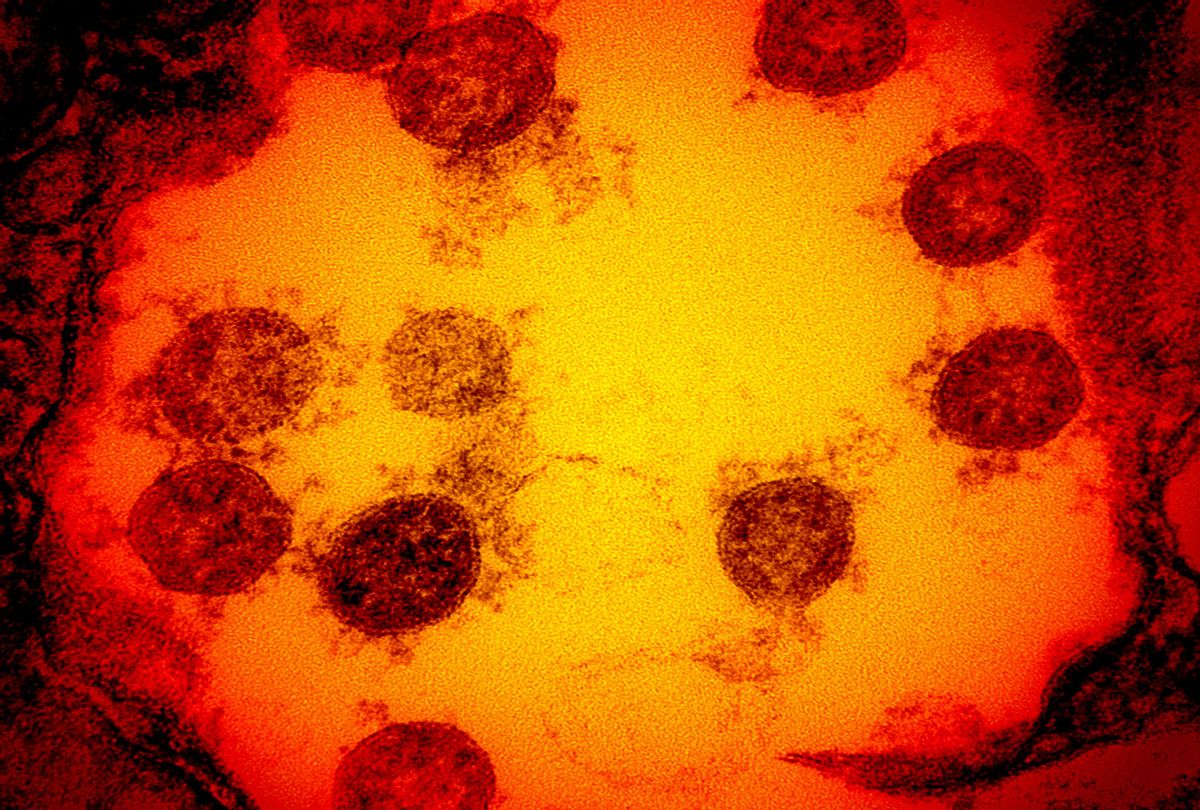 Transmission electron micrograph of SARS-CoV-2 virus particles, isolated from a patient. Image captured and color-enhanced at the NIAID Integrated Research Facility (IRF) in Fort Detrick, Maryland. (IMAGE POINT FR/NIH/NIAID/BSIP/Universal Images Group via Getty Images)