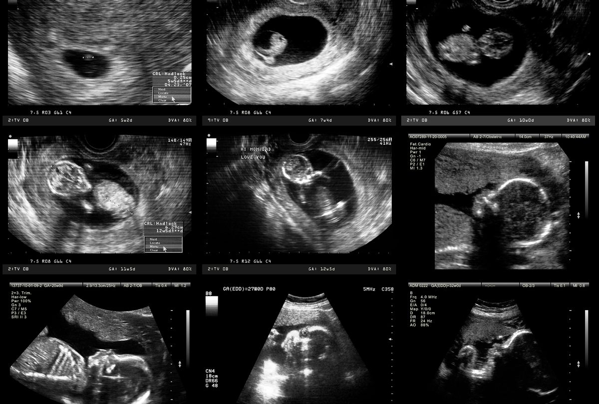 Medical imaging of various stages of embryo and fetal development during pregnancy (Getty stock photo)
