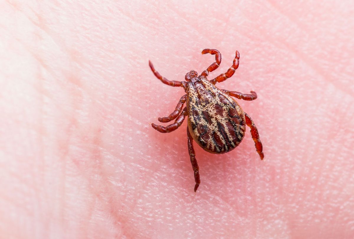 Tick on skin (Getty Images/nechaev-kon)