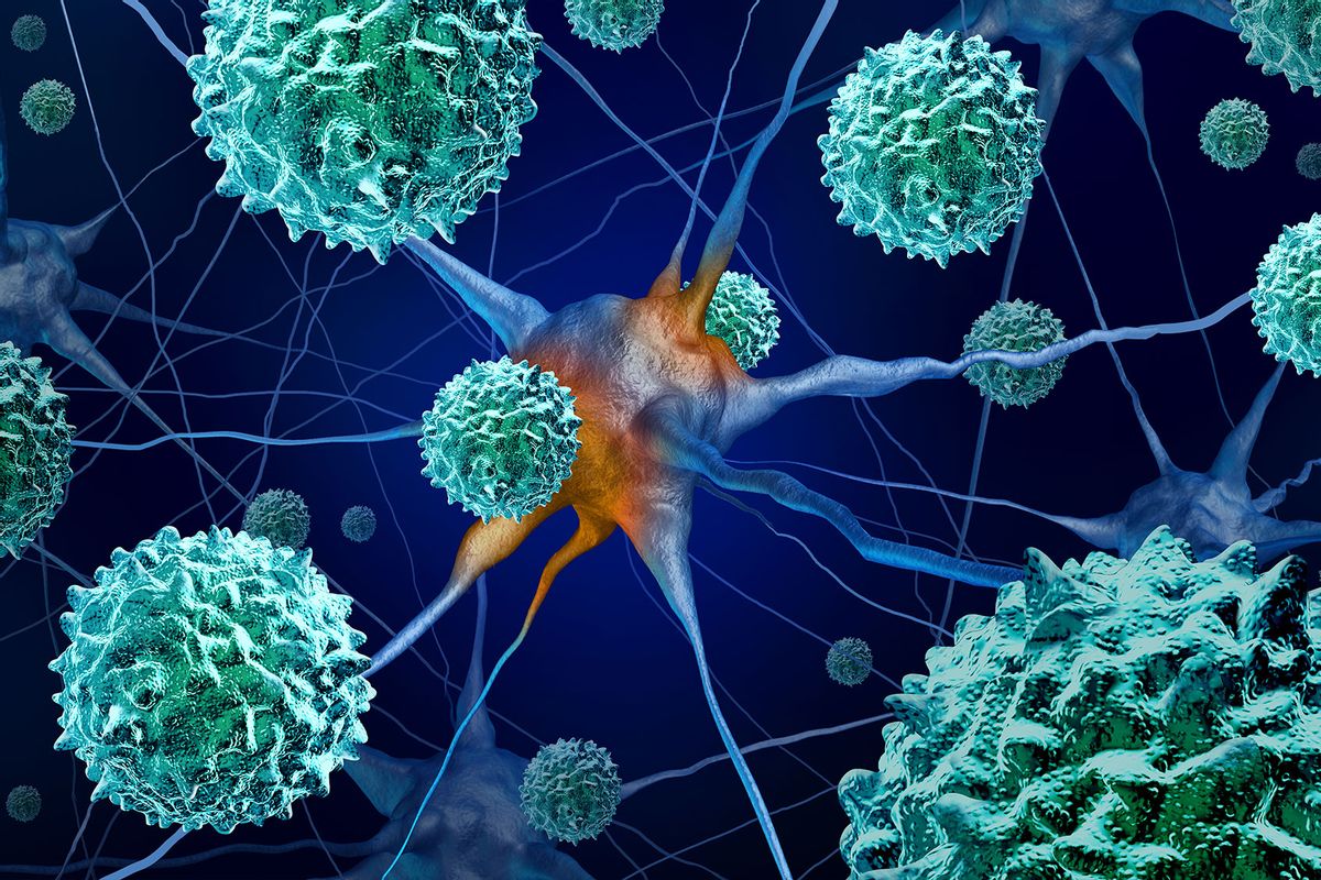 AFM disease or acute flaccid myelitis medical concept as a neurologic condition representing  enterovirus or polio virus, 3D illustration (Getty Images/wildpixel)