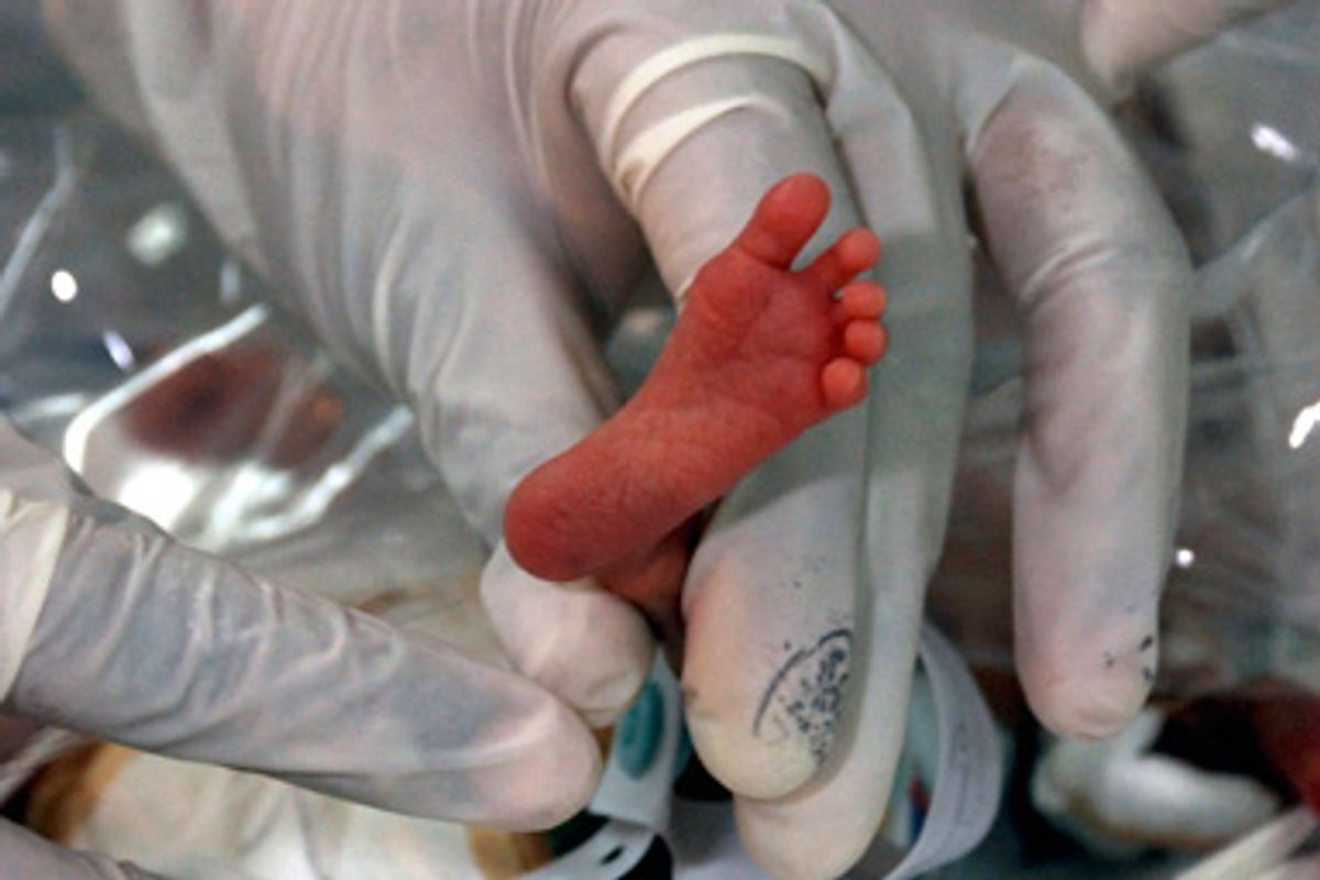 Above: A nurse holds the foot of Milagros Pimentel, a baby girl born at 20 weeks in a Colombia hospital.