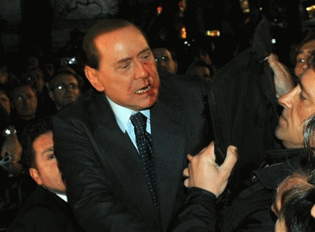 This image made available by the Italian Premier's office shows Italian Premier Silvio Berlusconi after an attacker hurled a statuette at him  at the end of a rally in Milan, Italy on Sunday. 