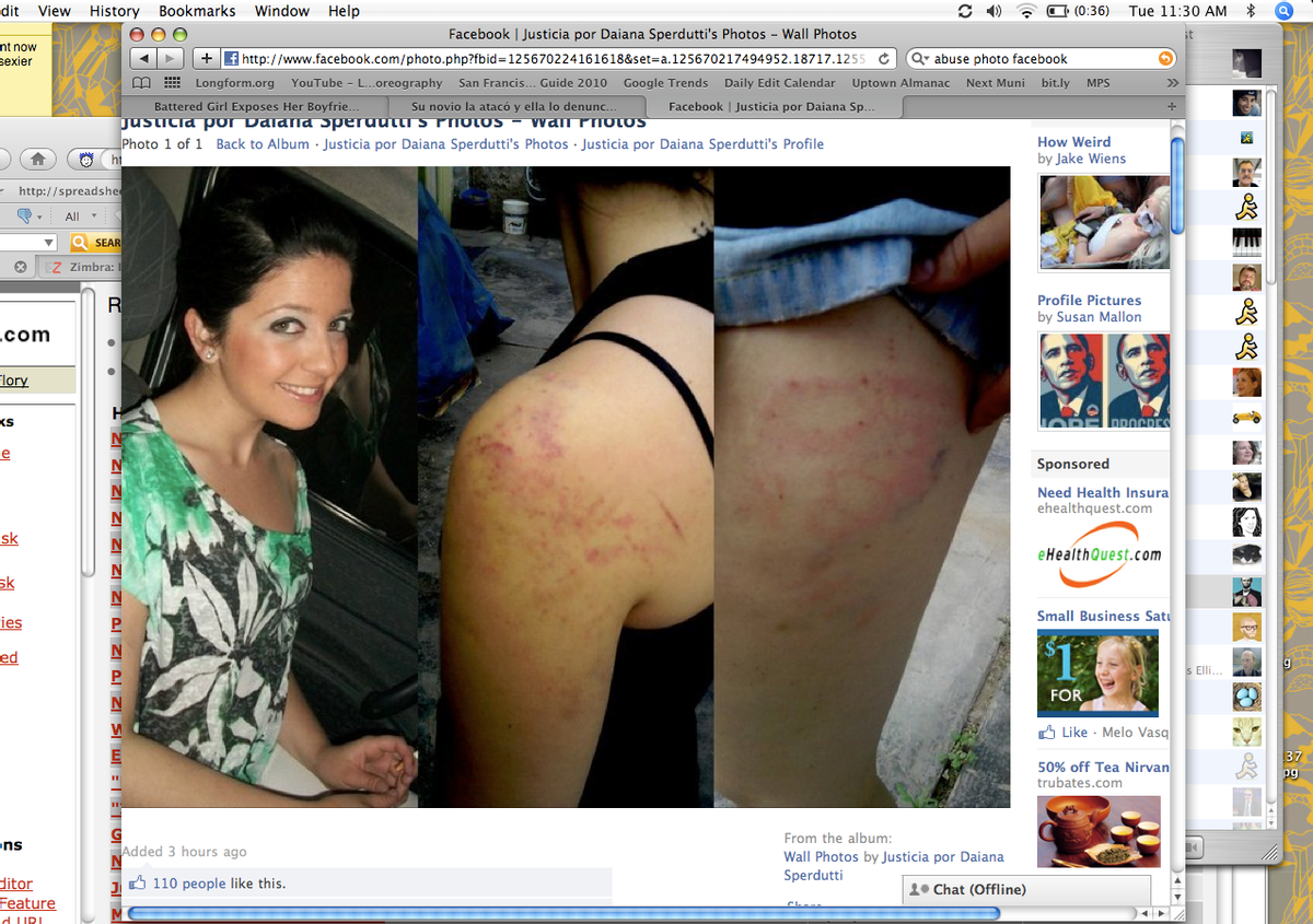 Photos of Daiana Sperdutti and her injuries from a Facebook fan page