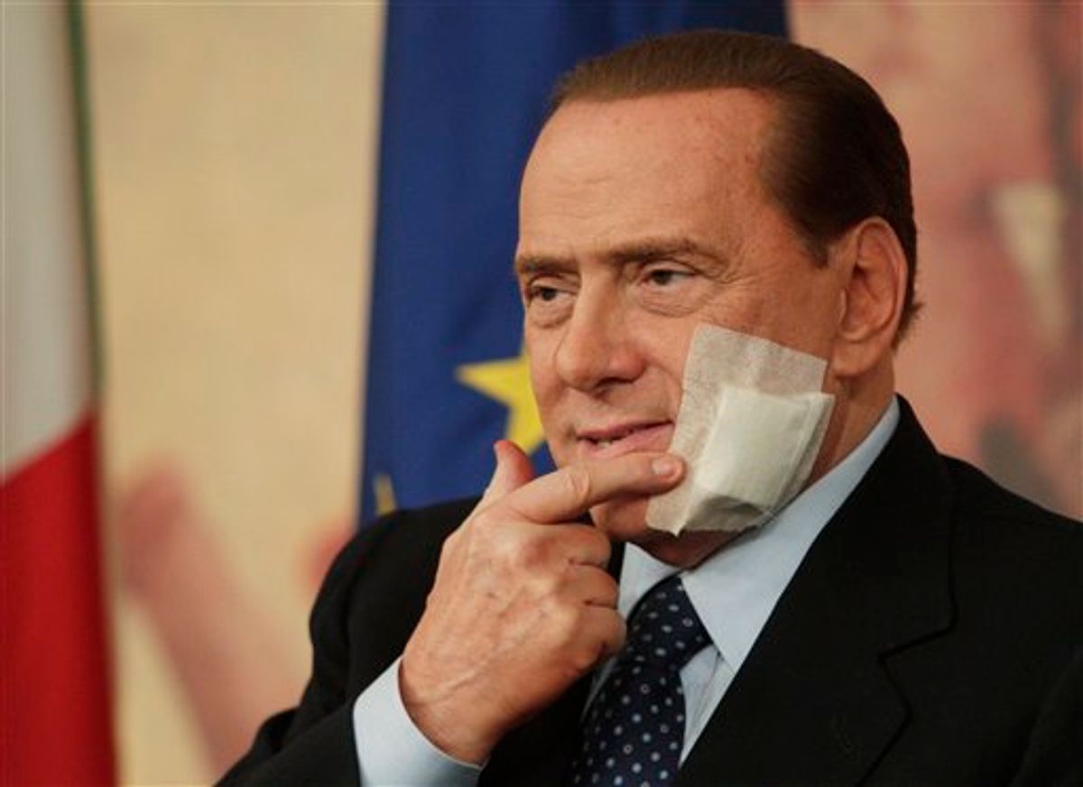 Italian Premier Silvio Berlusconi touches his face during a press conference following a cabinet meeting on the justice reforms, in Rome, Thursday, March 10, 2011. Berlusconi has an adhesive bandage on his face after undergoing jaw surgery earlier this week. (AP Photo/Andrew Medichini) (AP)