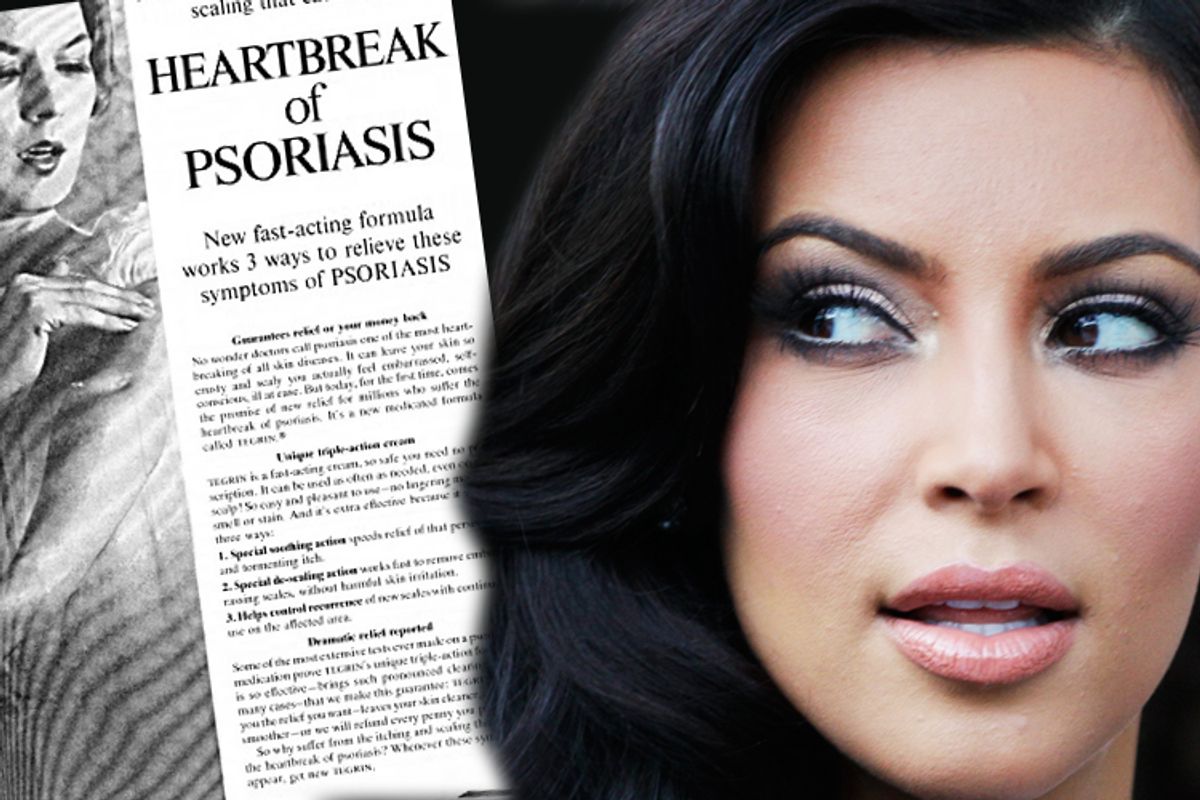 Kim Kardashian suffers from the heartbreak of psoriasis.   