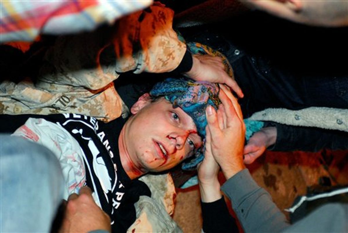 24-year-old Iraq War veteran Scott Olsen lays on the ground bleeding from a head wound after being struck by a by a projectile during an Occupy Wall Street protest in Oakland, Calif, last month.  (AP/Jay Finneburgh)