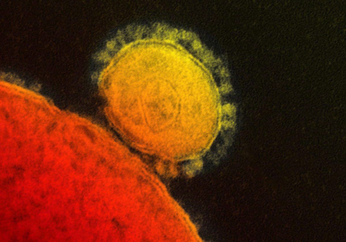 FILE - This file photo provided by the National Institute for Allergy and Infectious Diseases shows a colorized transmission of the MERS coronavirus that emerged in 2012.   ((AP Photo/National Institute for Allergy and Infectious Diseases via The Canadian Press, File))
