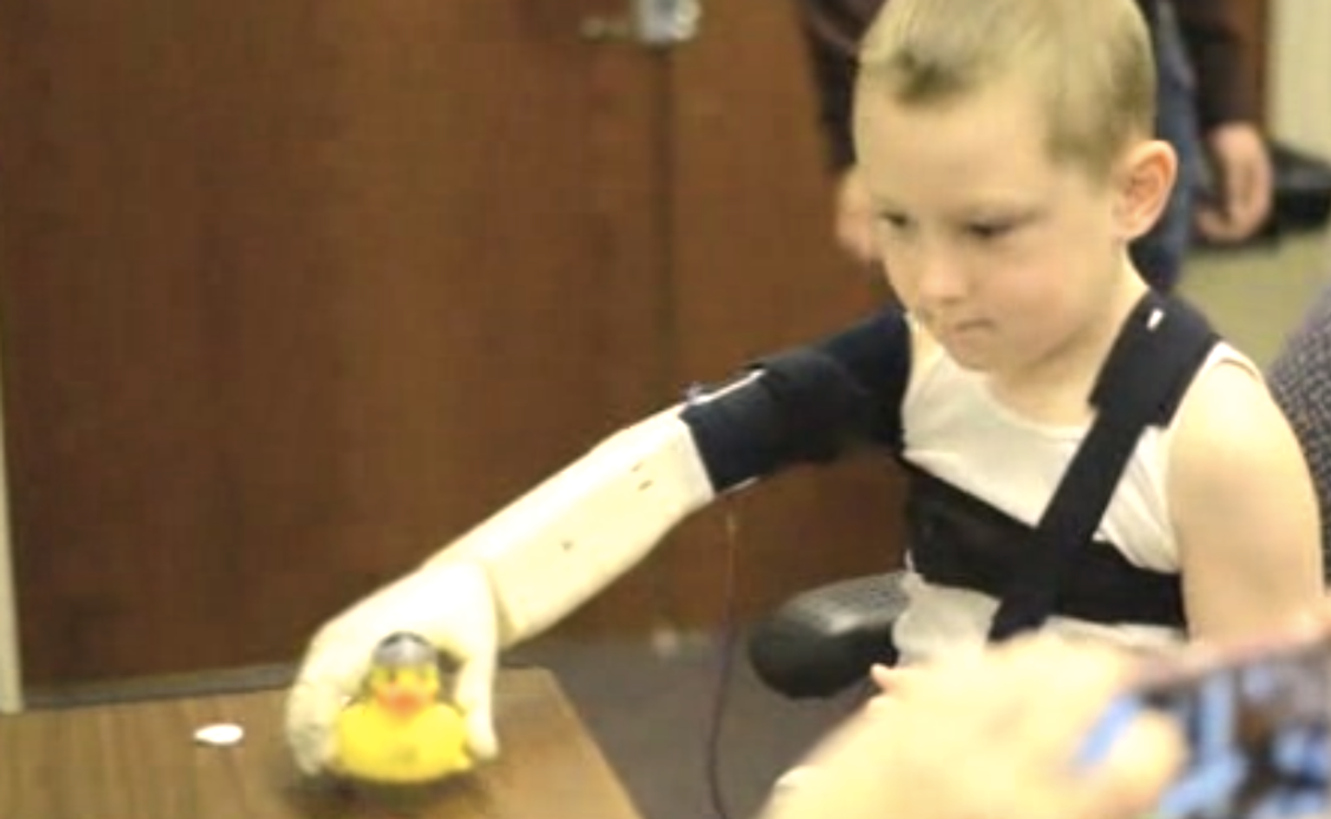 Alex Pring's bionic arm     (screenshot)