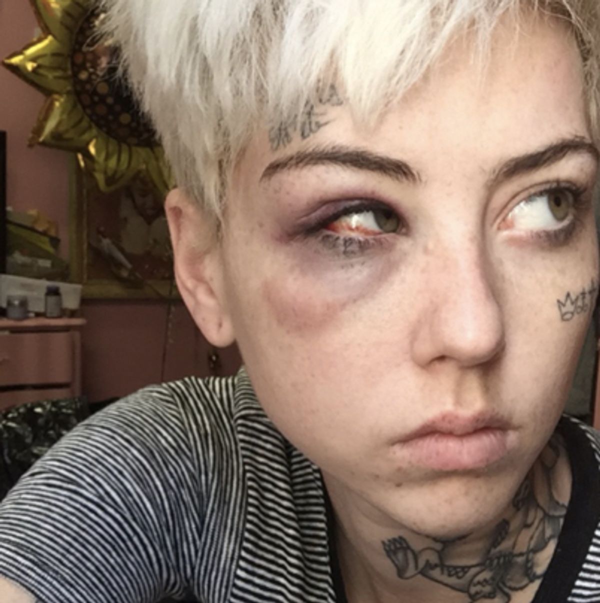 Los Angeles artist Illma Gore, 24, says she was accosted and punched over her drawing of a naked Donald Trump (Illma Gore)