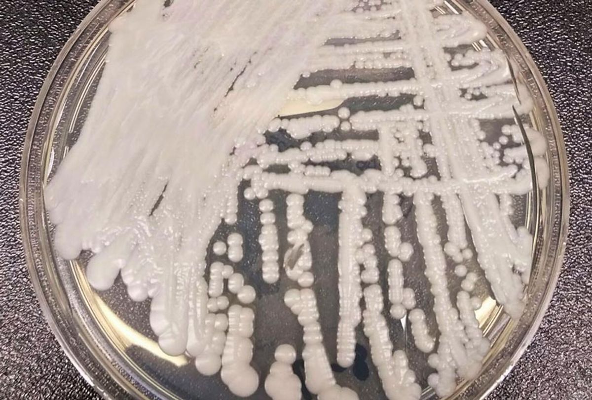 Candida auris in a petri dish at the CDC. (Wikimedia)