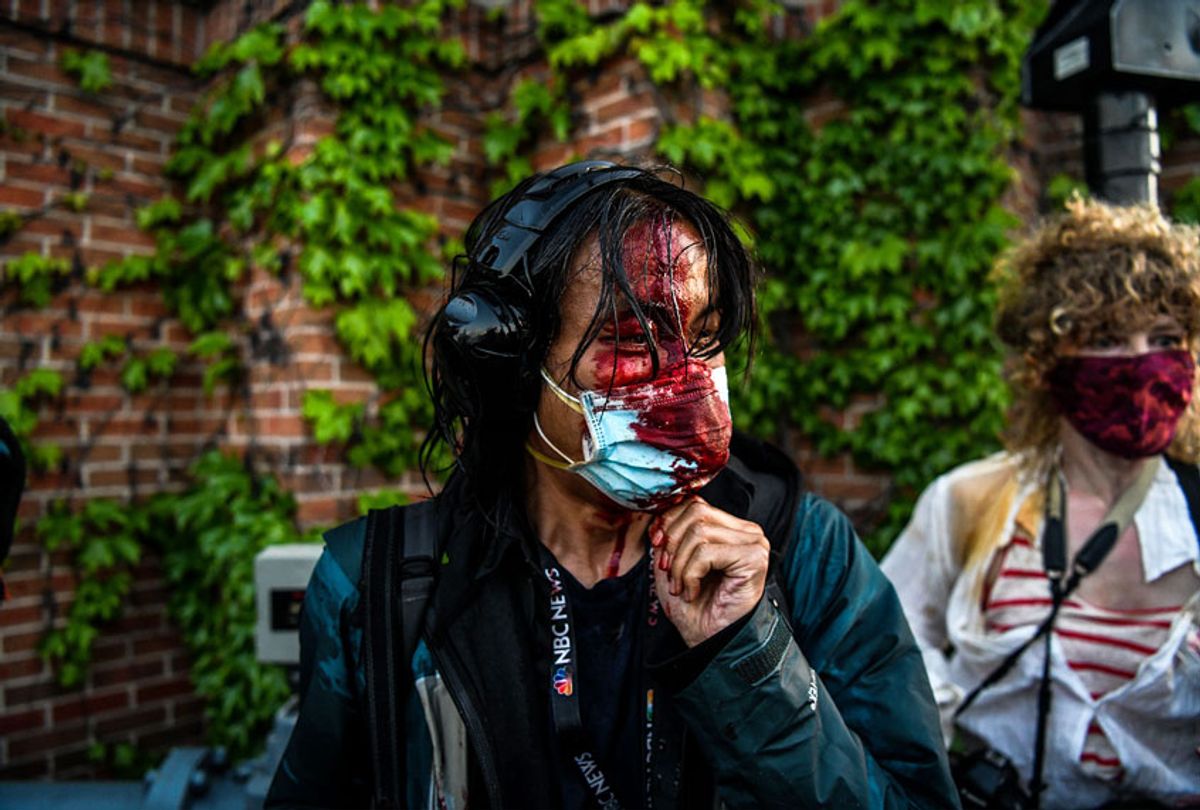 A journalist is seen bleeding after police started firing tear gas and rubber bullets near the fifth police precinct following a demonstration to call for justice for George Floyd on Saturday in Minneapolis. (Chandan Khanna/Getty Images)