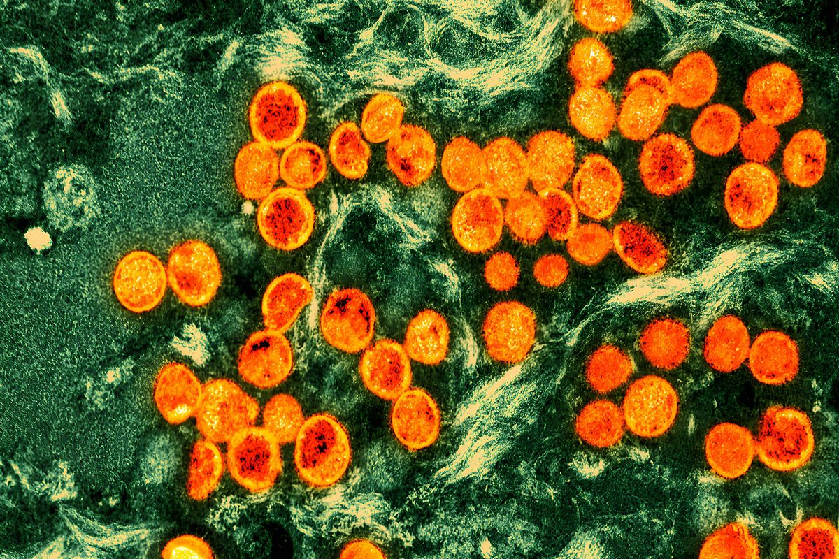 Colorized transmission electron micrograph of monkeypox virus particles (orange) found within an infected cell (green) (Getty Images/NIH-NIAID/IMAGE POINT FR/BSIP/Universal Images Group)