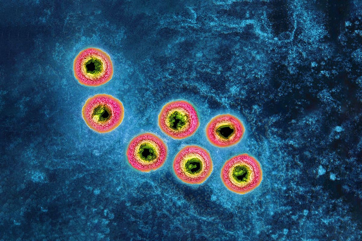 Herpes virus (CAVALLINI JAMES/BSIP/Universal Images Group via Getty Images)
