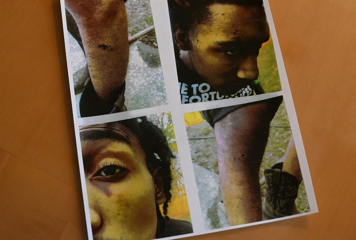Photos of Monterrious Harris with bruises and scars are displayed on a table at his attorneys' office on January 31, 2023 in Memphis, Tennessee. Harris was beaten by some of the same Memphis police officers from the Scorpion Unit that beat Tyre Nichols. (Joshua Lott/The Washington Post via Getty Images)