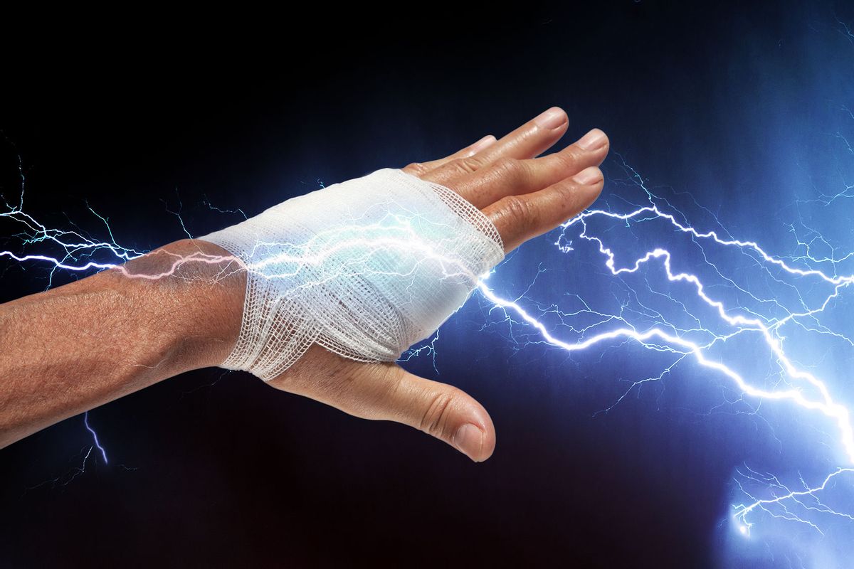 Bandaged Hand and Electricity (Photo illustration by Salon/Getty Images)