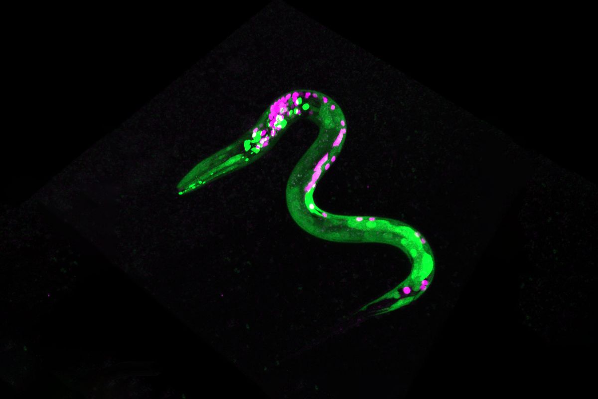 Image of a worm that is genetically engineered so that certain neurons and muscles are fluorescent. (Stacy Levichev)