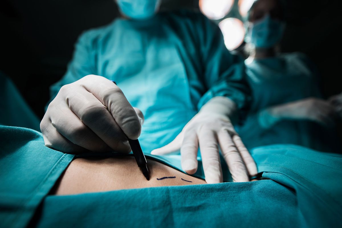 Doctor marking the human skin for surgery (Getty Images/BraunS)