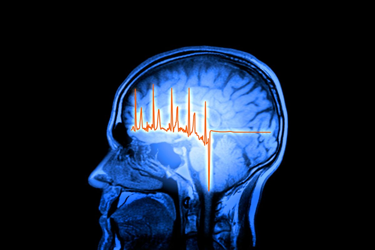 Computer artwork of an ECG (electrocardiogram) trace in front of a human brain (Getty Images/PASIEKA)