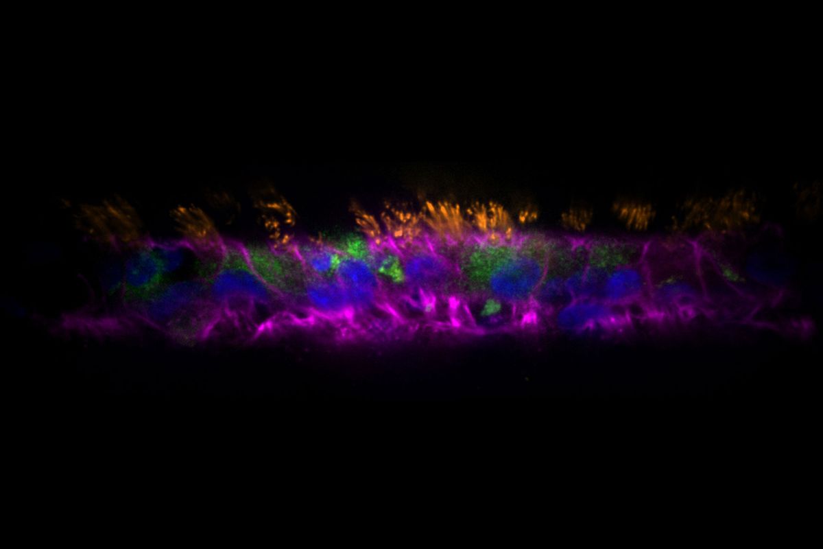 Human airway epithelial cells after growth and differentiation inside an AirGel tissue-engineered airway. Green: mucus; orange: cilia; pink: actin; blue: nuclei. (Tamara Rossy (EPFL))