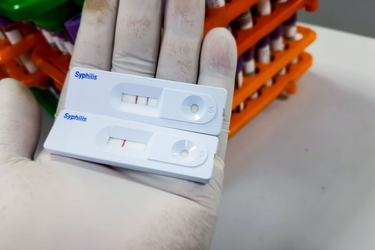 Rapid test cassette for Syphilis test, Rapid TPHA test, positive and negative results showing (Getty Images/Md Babul Hosen)