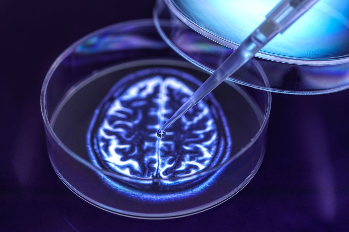 Neurology research, concept (Getty Images/TEK IMAGE/SCIENCE PHOTO LIBRARY)
