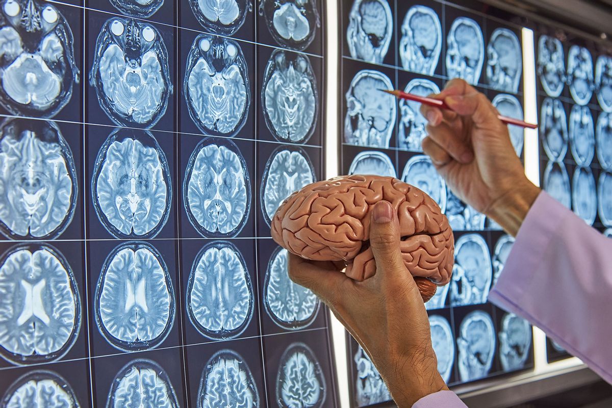 A neurosurgeon holding human brain model and pointing at brain MRI on lightbox in medical office (Getty Images/undefined undefined)