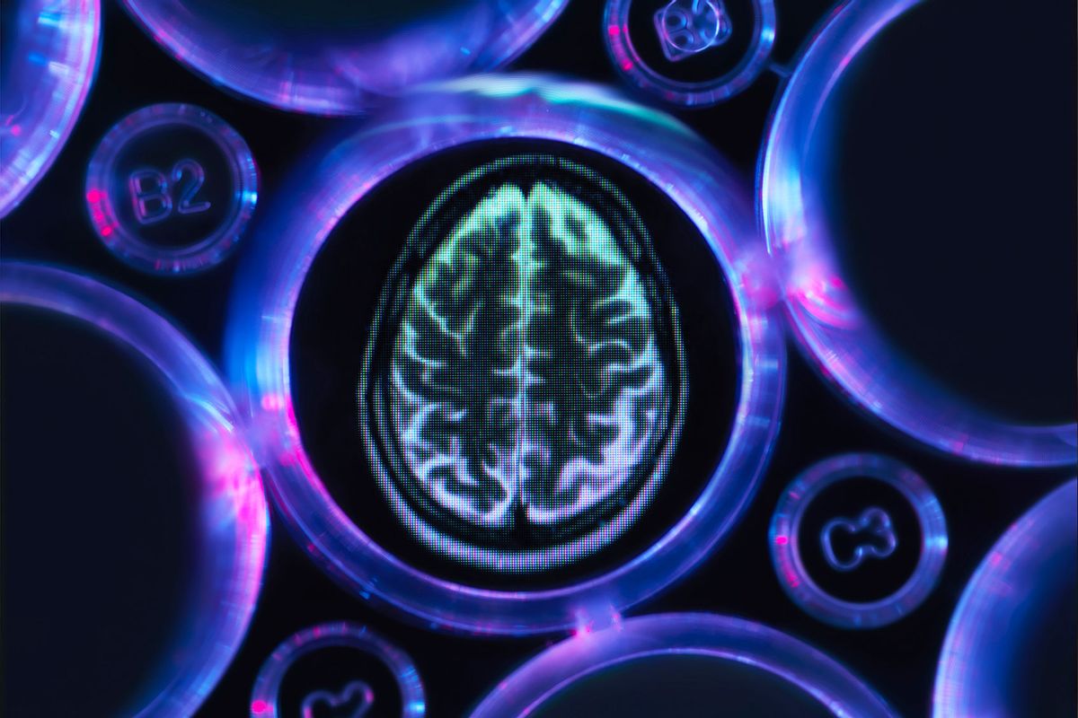 Alzheimers and dementia research, a brain scan in multi well tray used for research experiments in laboratory (Getty Images/Andrew Brookes)