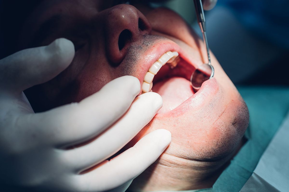 Dentist carrying out dental procedure on patient (Getty Images/Eugenio Marongiu)