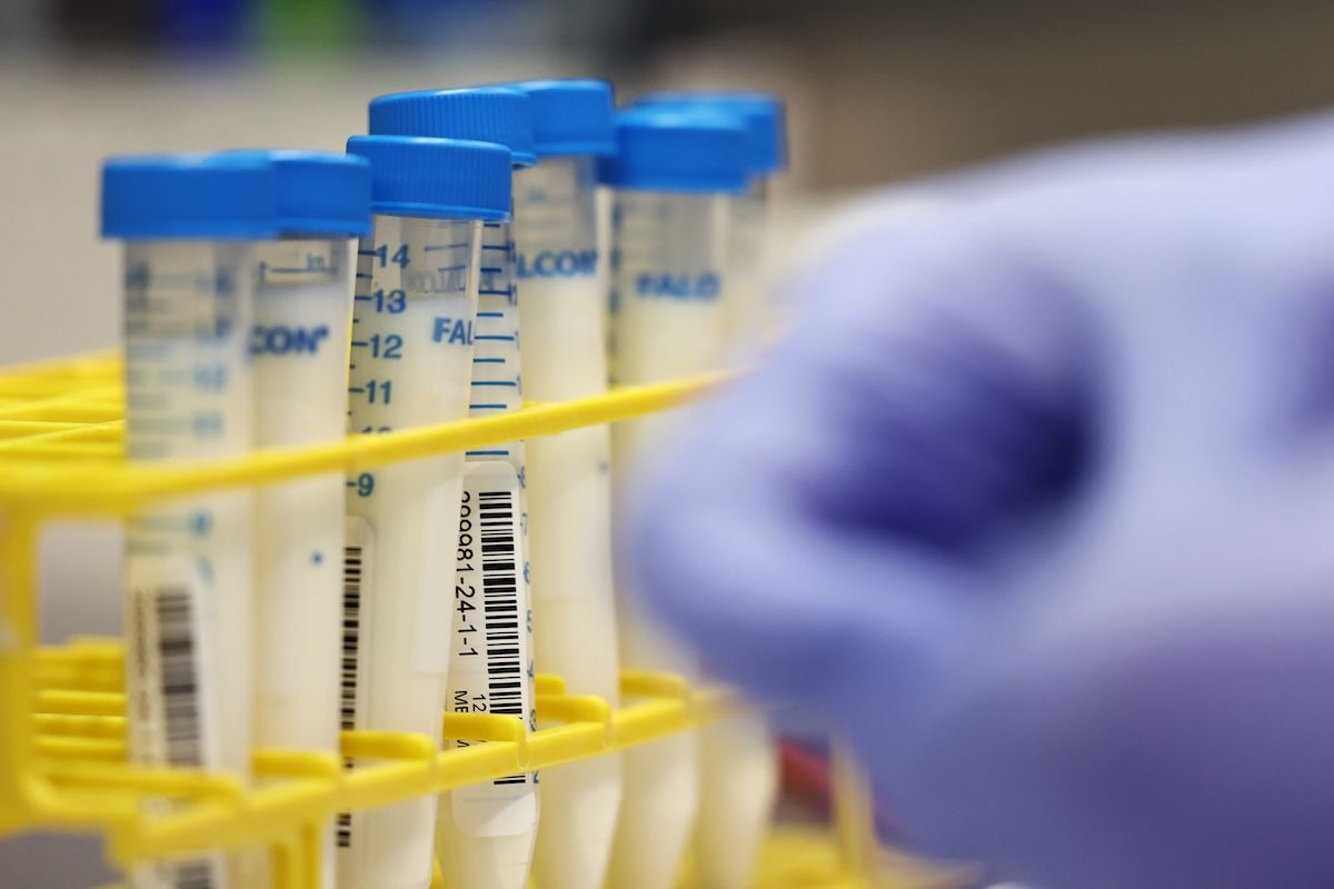 Milk samples are seen as HDC receiving staff prep them for testing at the Animal Health Diagnostic Center at Cornell University on December 10, 2024 in Ithaca, New York.  (Photo by Michael M. Santiago/Getty Images)