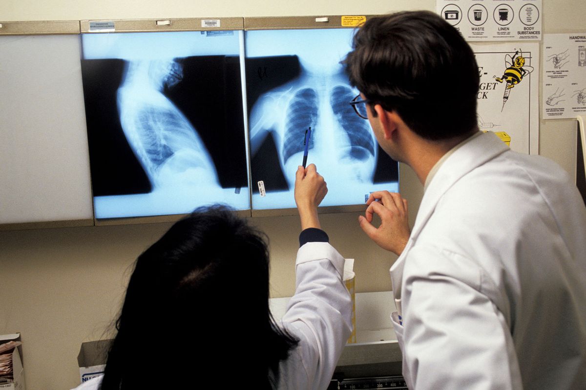 Doctors examine an x-ray of a patient who has tuberculosis (Najlah Feanny/Corbis via Getty Images)